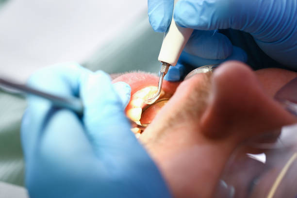 Best Emergency Denture Repair in Daly City, CA