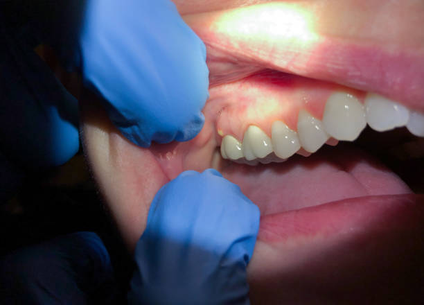 Best Cosmetic Emergency Dentistry in Daly City, CA